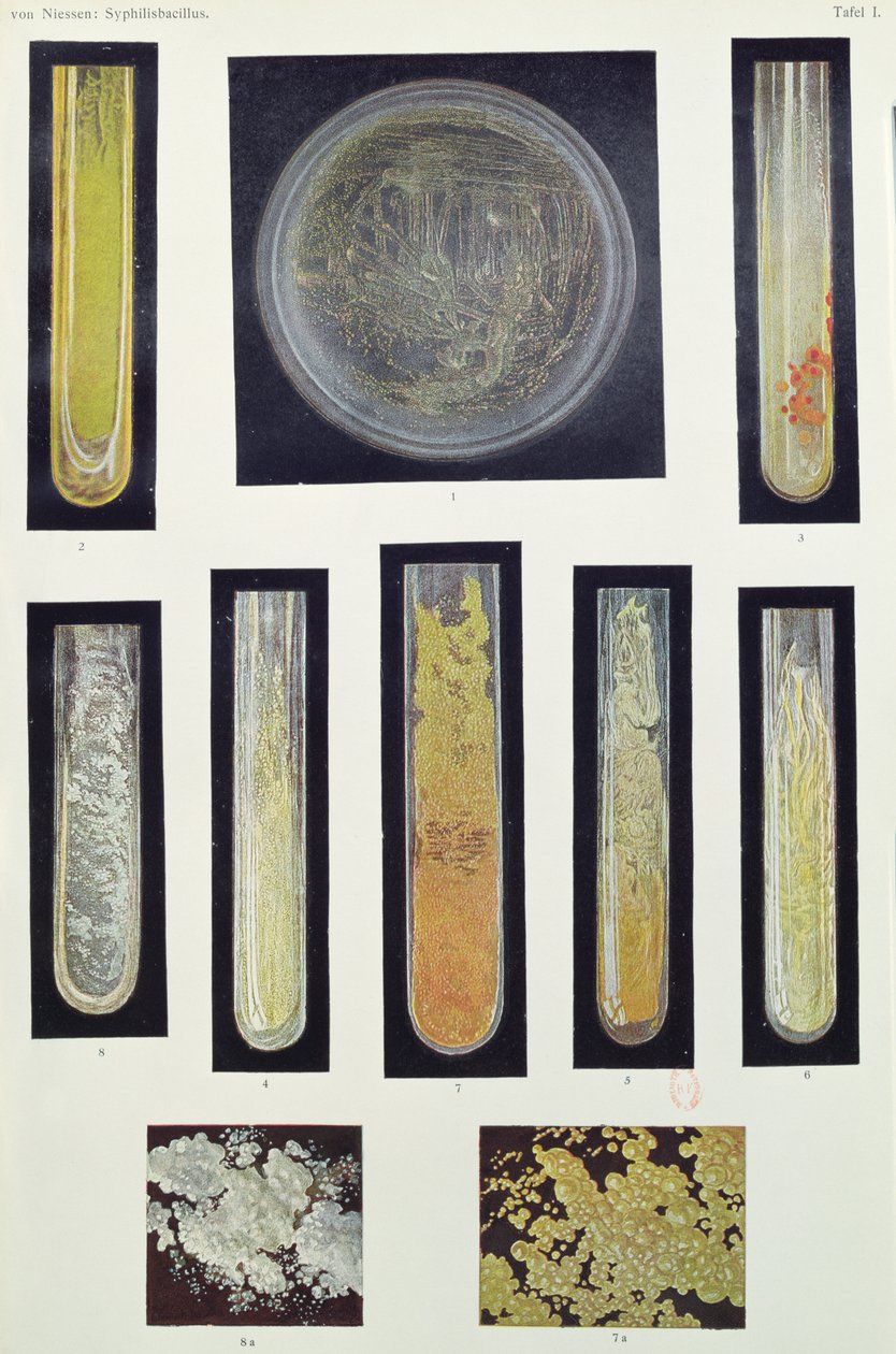 Bacilo de la sífilis, de un libro por Max von Niessen, Leipzig, 1908 de German School