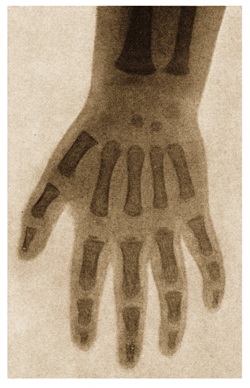 Radiografía de la mano de un niño c.1890 de German School