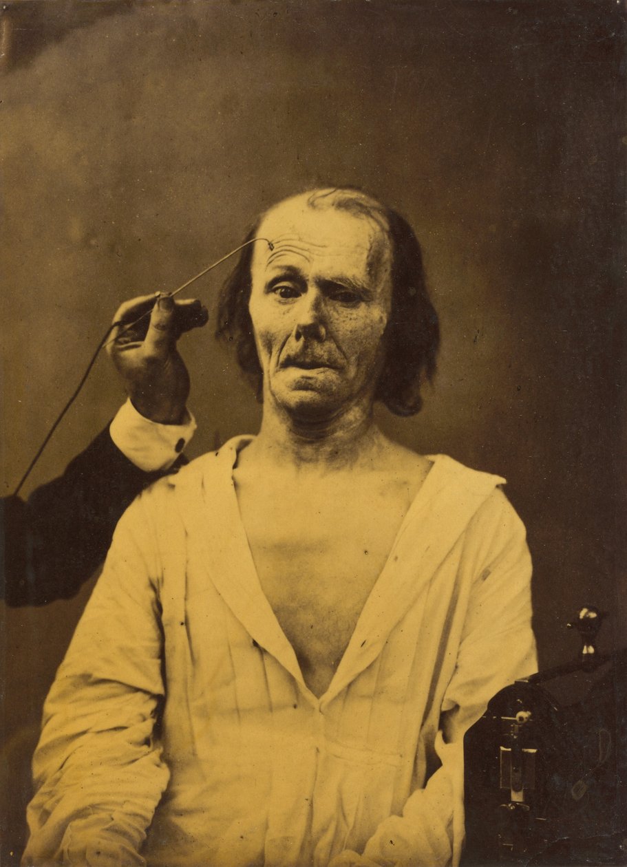 Un rostro relajado (izquierda); Profunda atención (derecha),1854-1856, impreso 1862 (foto) de Guillaume Benjamin Armand Duchenne de Boulogne