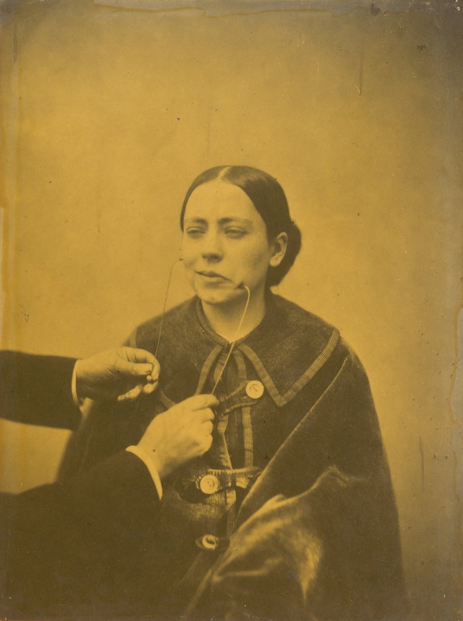 Asco despreciativo (izquierda); Risa despreciativa (derecha),1854-1856, impreso 1862 (foto) de Guillaume Benjamin Armand Duchenne de Boulogne
