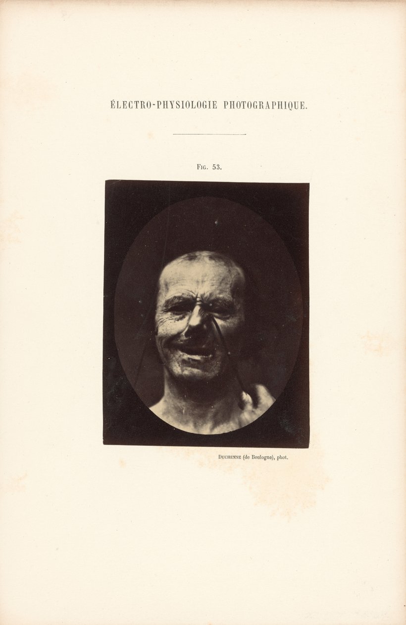 Electrofisiología fotográfica, Figura 53 de Guillaume Benjamin Duchenne