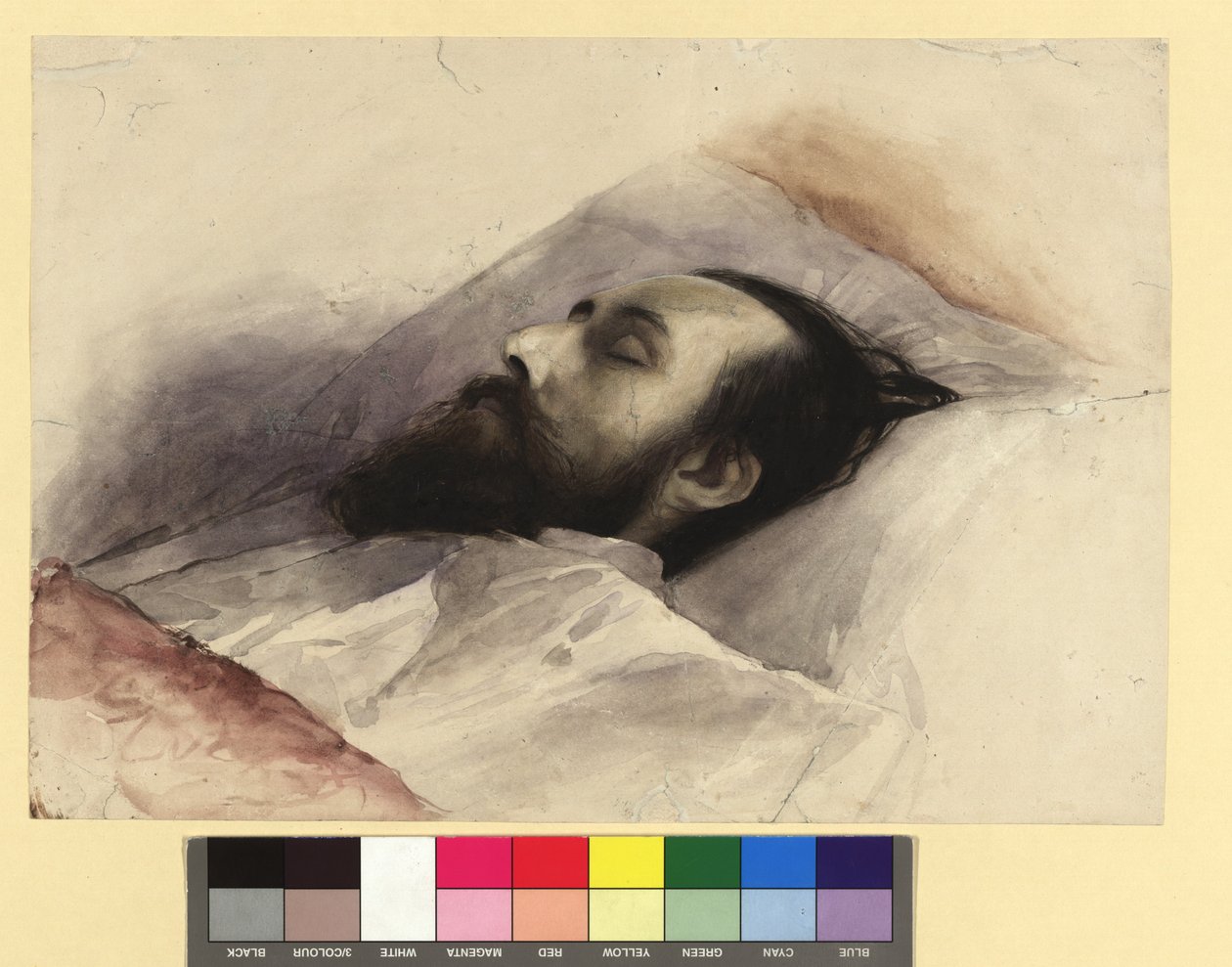 Julius Lott (1836-1883) en su lecho de muerte de Gustav Klimt