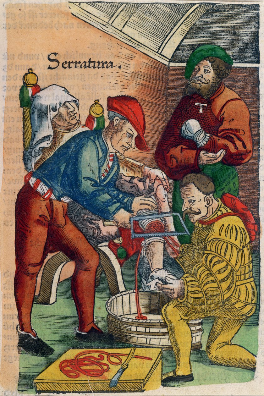 Una Amputación, ilustración de 