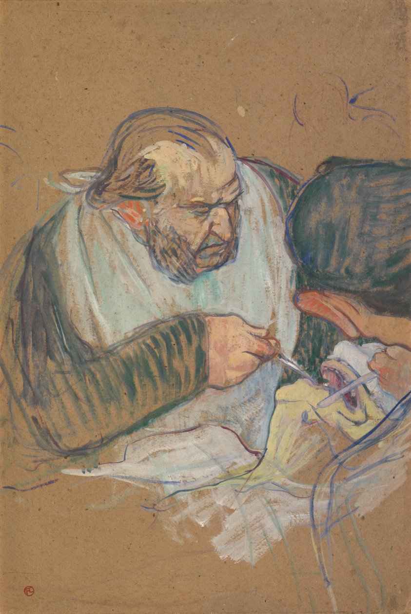 El Dr. Péan operando de Henri de Toulouse-Lautrec