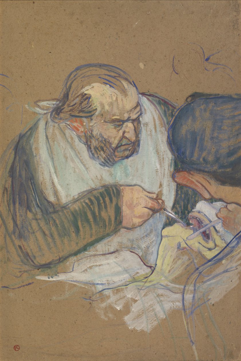 El Dr. Péan operando de Henri de Toulouse Lautrec
