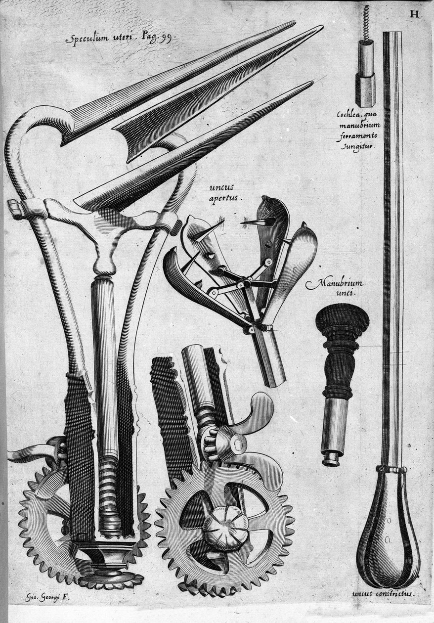 Ginecología: Placa que representa un espéculo. Grabado por Girolamo Fabricii en "Opera Surgica", Padua de Hieronymus Fabricius ab Aquapendente