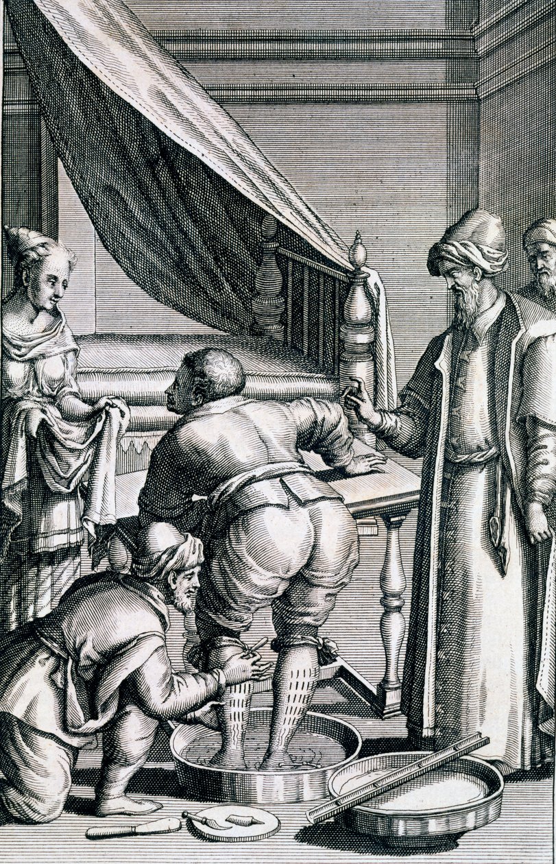 Sangría en las piernas, de Medicina Aegyptiorum por Prospero Alpini, publicado 1745 de Italian School