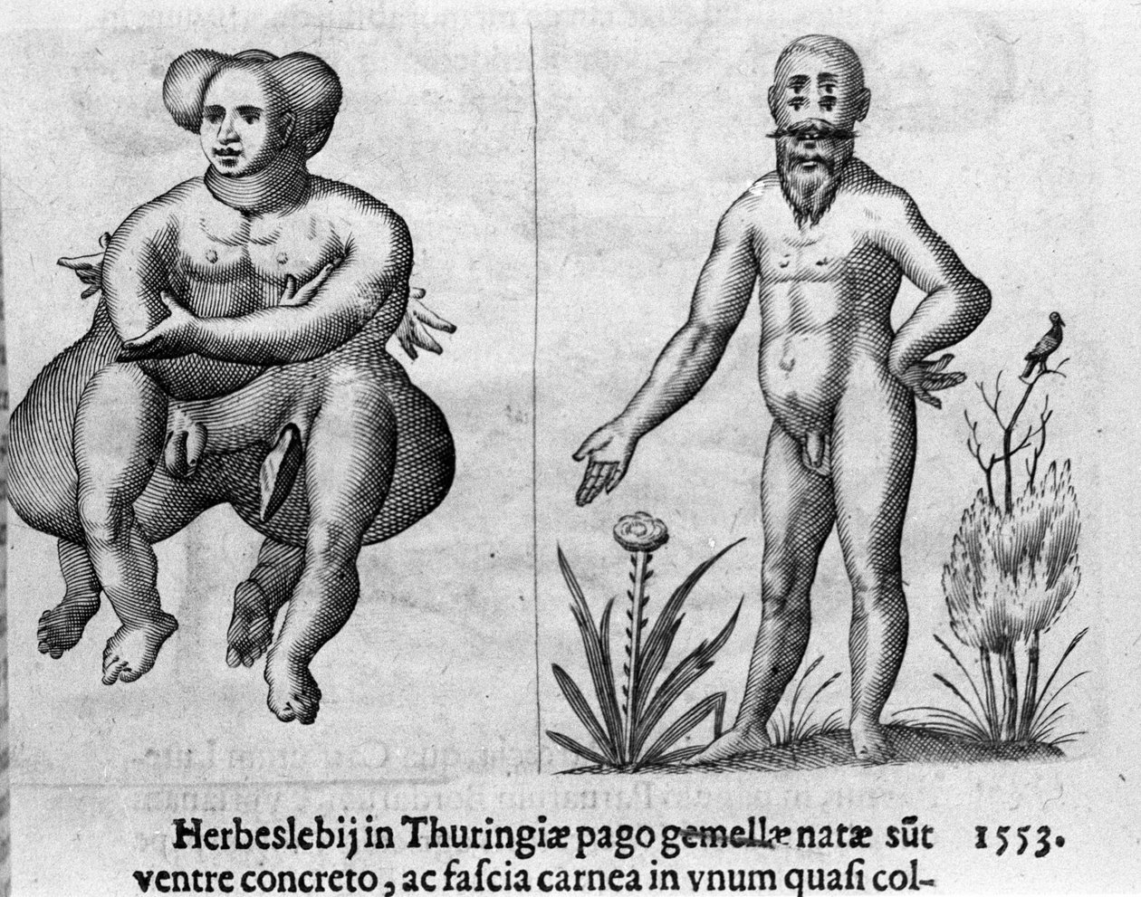Diferentes tipos de monstruos humanos. Grabado de “De monstrorum natura, causis et differentiis” de Fortunio Liceti (1577-1656), científico italiano. 1646 de Italian School
