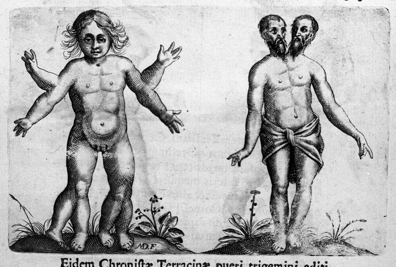 Diferentes tipos de monstruos humanos. Grabado de “De monstrorum natura, causis et differentiis” de Fortunio Liceti (1577-1656), científico italiano. 1646 de Italian School