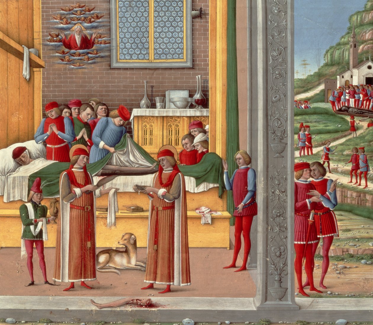 Escena de amputación medieval (temple sobre tabla) de Italian School