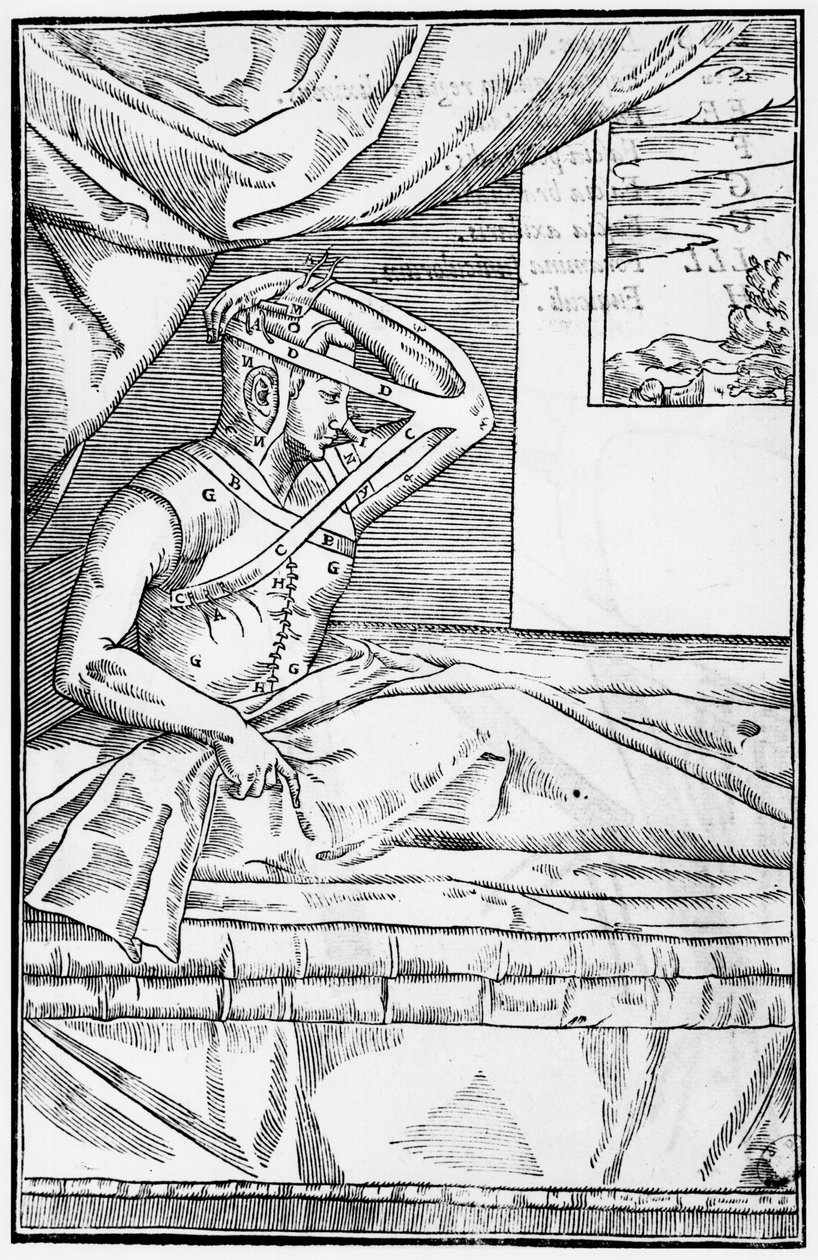 Cirugía reconstructiva en la nariz, ilustración de De curtorum chirurgia per insitionem por Gaspare Tagliacozzi (1545-99) Venecia, publicado en 1597 de Italian School