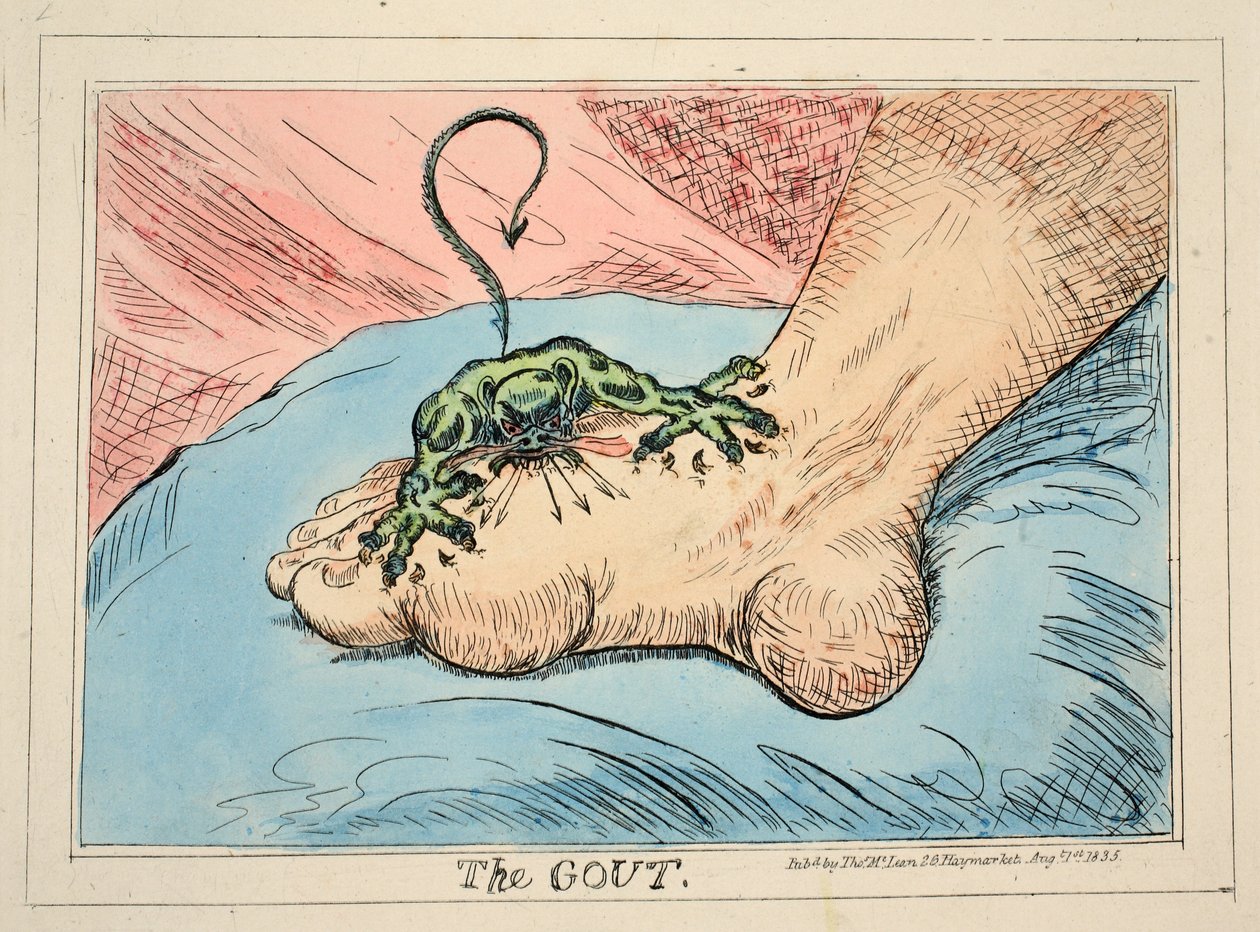 La Gota, pub. 1835 de James Gillray