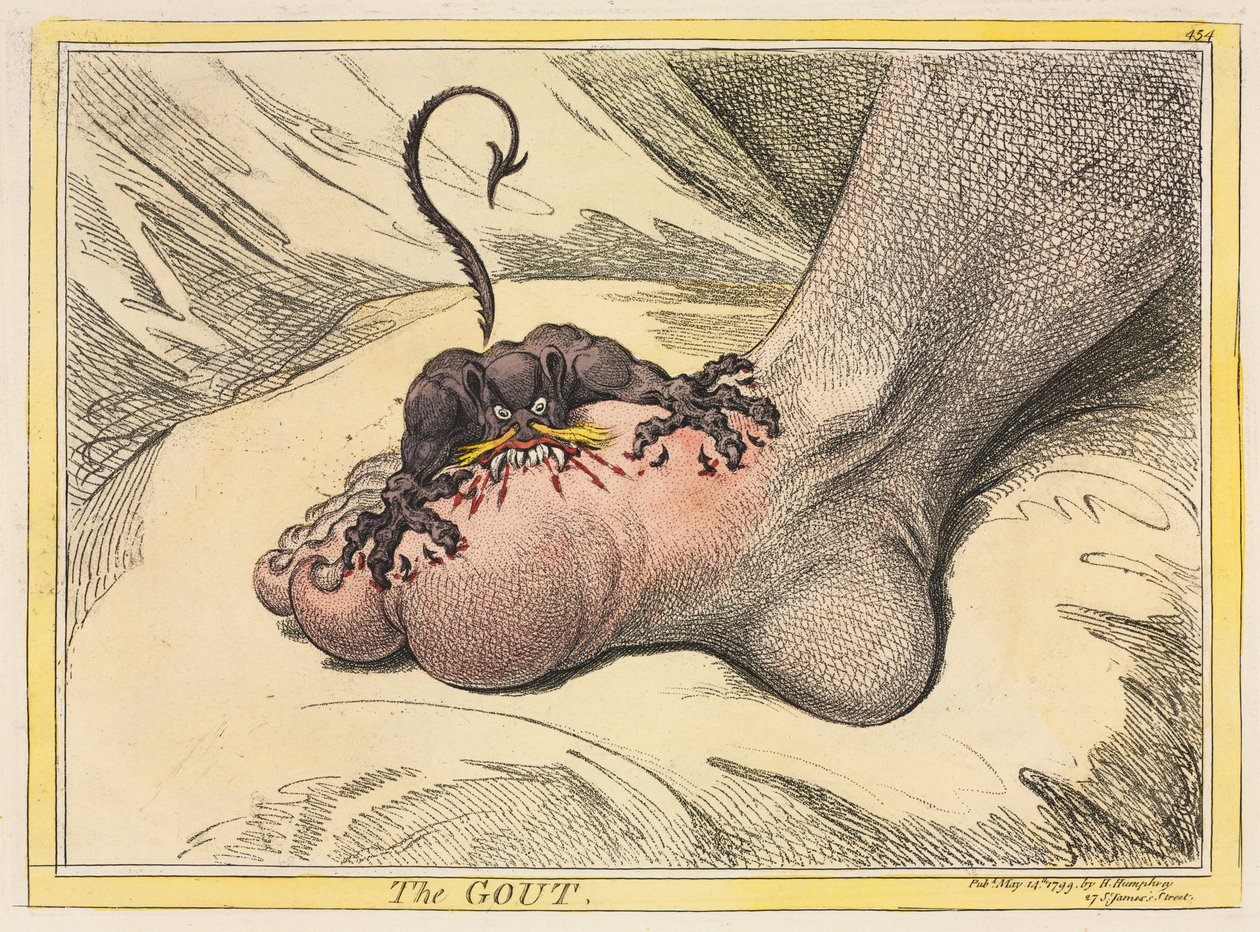 La gota de James Gillray