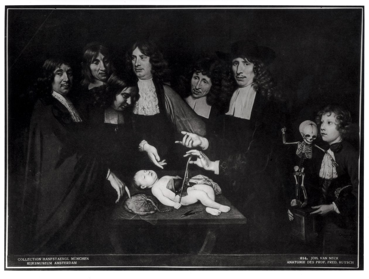 La Lección de Anatomía del Profesor Frederik Ruysch (1638-1731) c.1683 de Jan van Neck