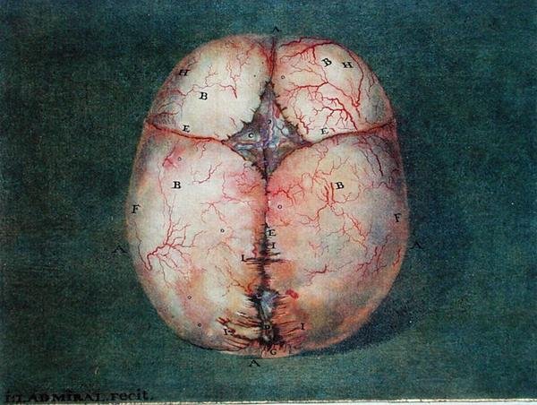 El cerebro, de 