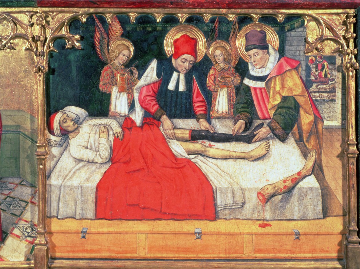 126-0035321 SS. Cosme y Damián injertan la pierna de un etíope en el muñón del diácono Justiniano; de Jaume Huguet