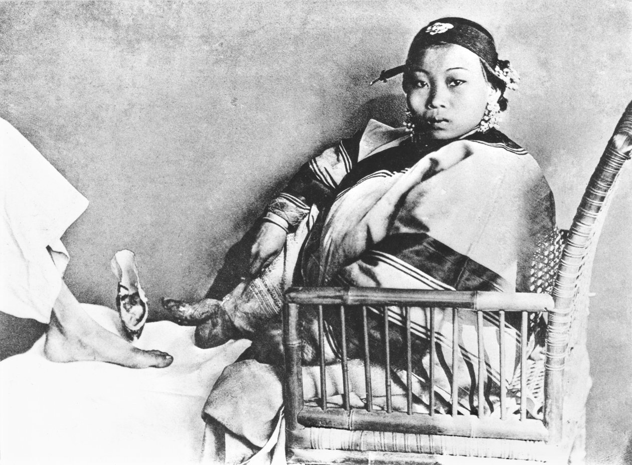 Mujer china mostrando su pie vendado descubierto junto a un pie europeo de John Thomson