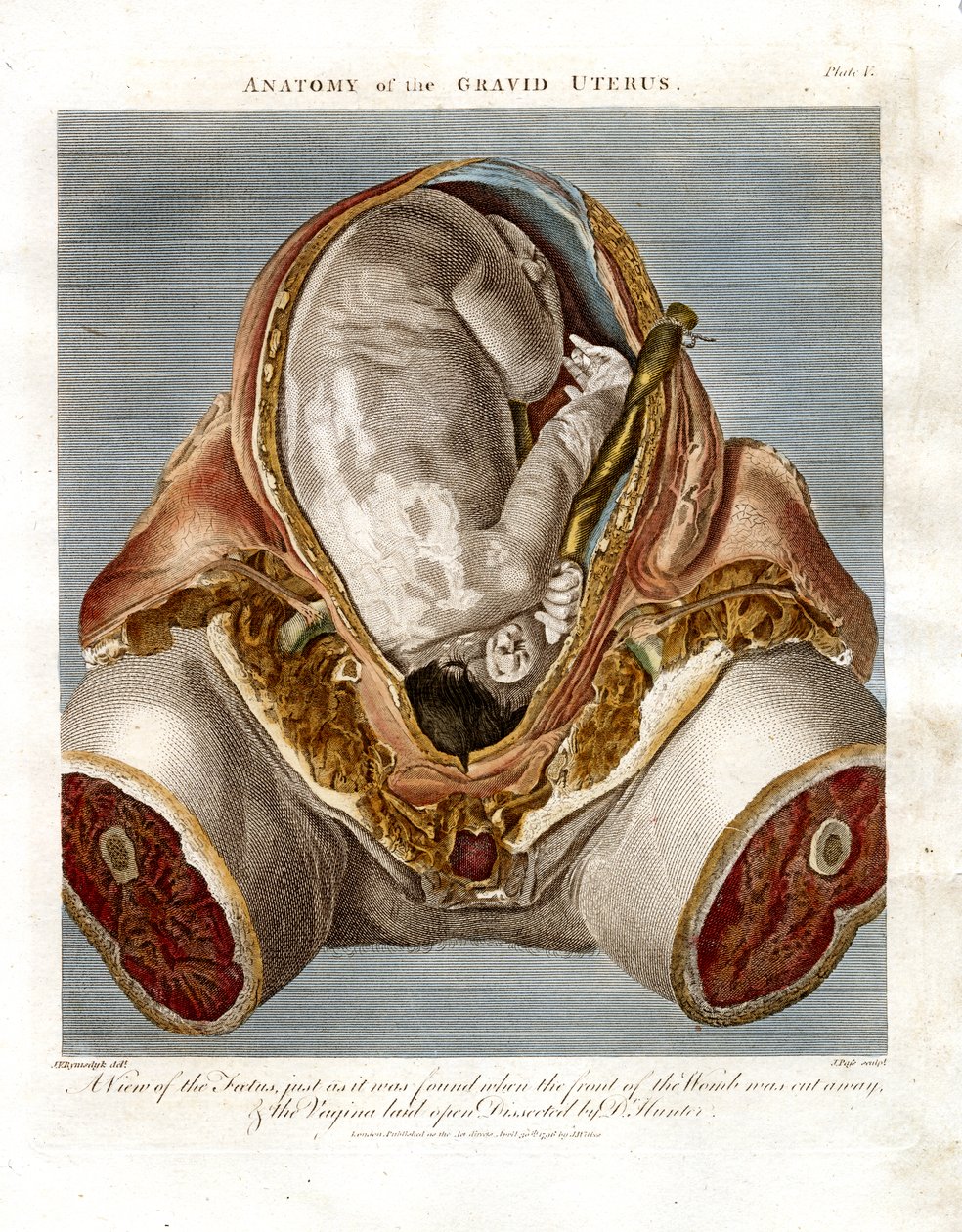 Anatomía del útero grávido de John Pass
