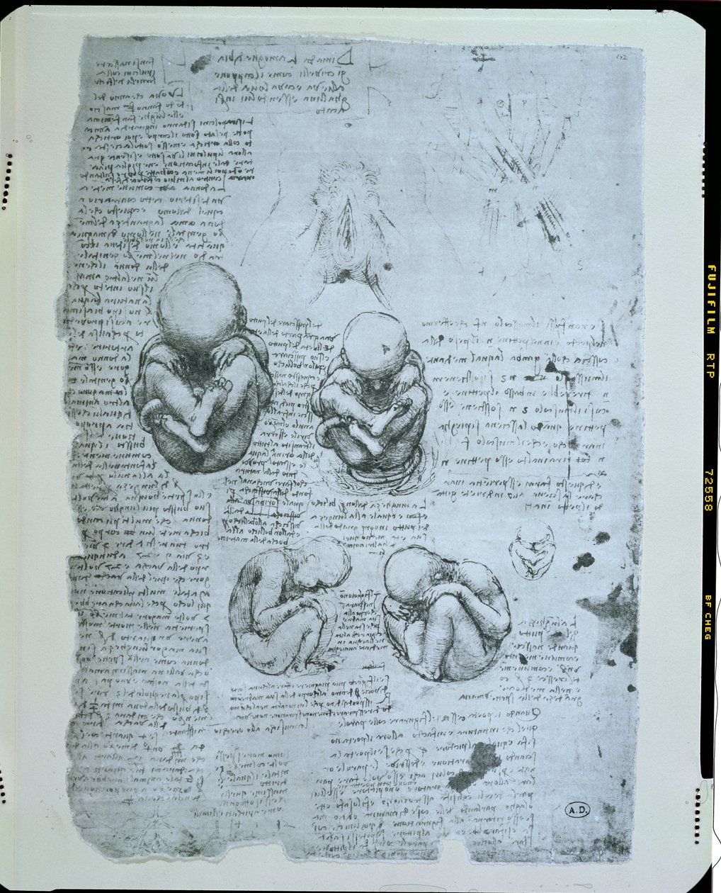 Cinco vistas de un feto en el útero, copia facsímil de Leonardo da Vinci