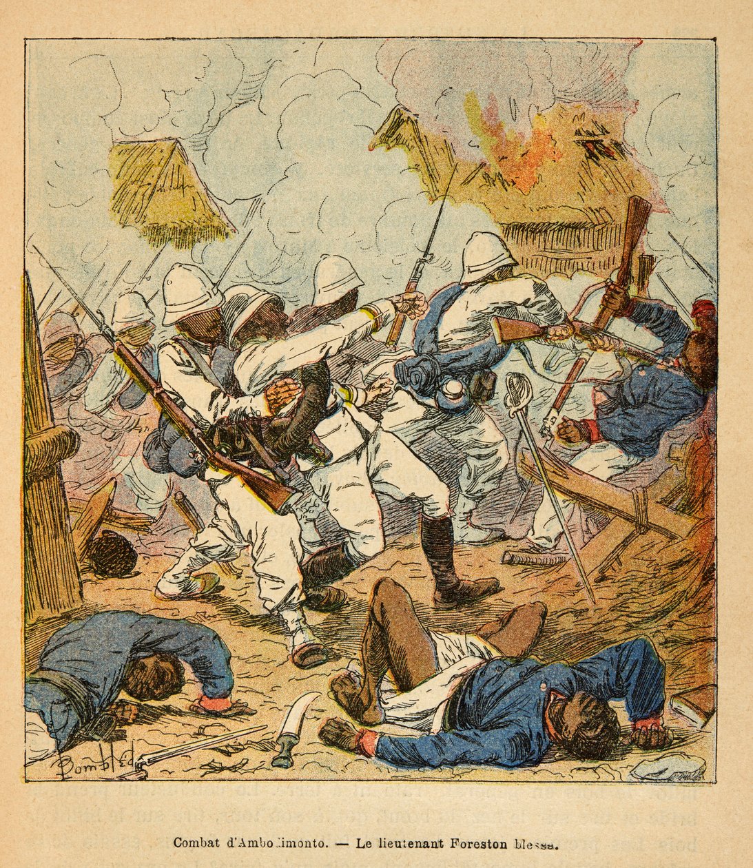 La Guerra en Madagascar-Historia Anecdótica de las Expediciones Francesas de 1885-1895 por Henri Galli, ilustrado por Louis Bombled: El Teniente Foreston herido durante las batallas de Ambolomonty en 1895, Colección Privada de Louis Charles Bombled