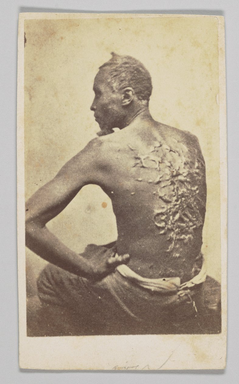 Gordon bajo inspección médica, 1863 de McPherson and Oliver