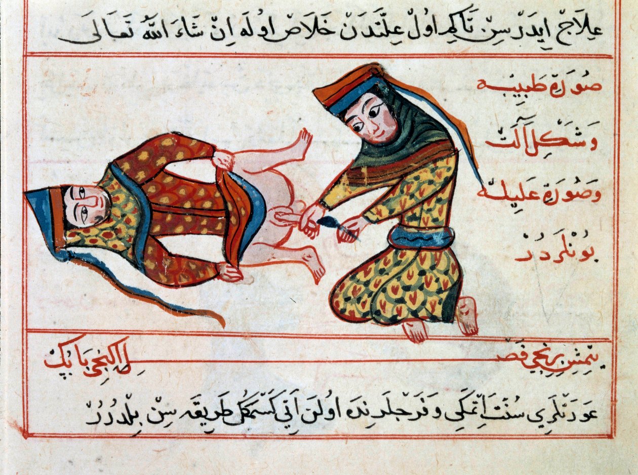 Medicina: operación de un hermafrodita. Miniatura de un tratado de medicina turca por Sharaf al-din de Ottoman School