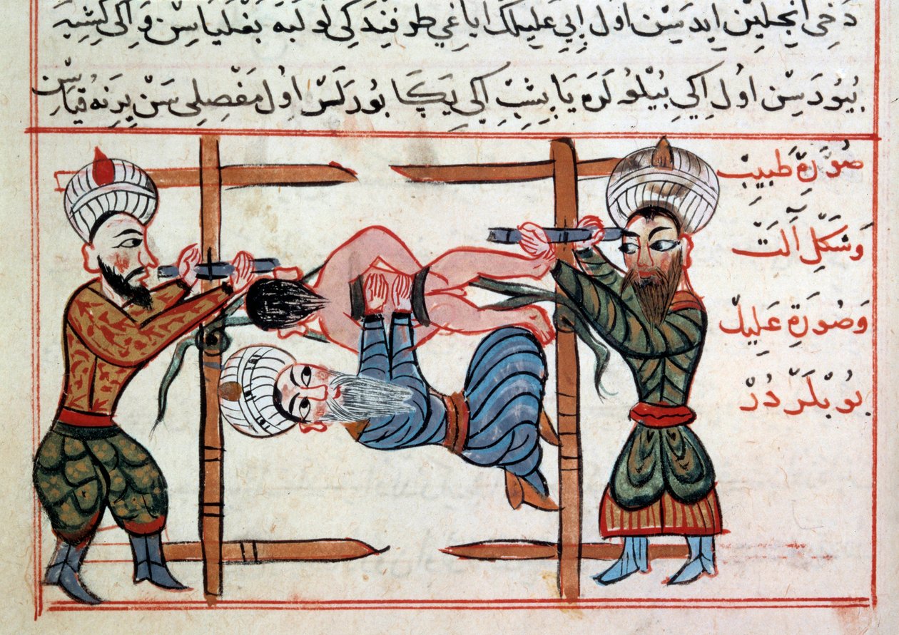 Reducción de una fractura. Miniatura de un tratado de medicina turca por Sharaf al-din de Ottoman School