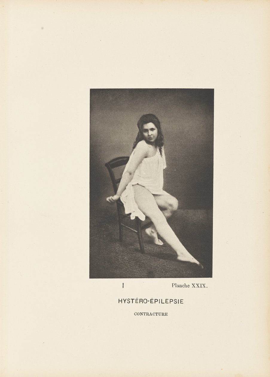 Contractura histeroepiléptica de Paul Marie Léon Regnard