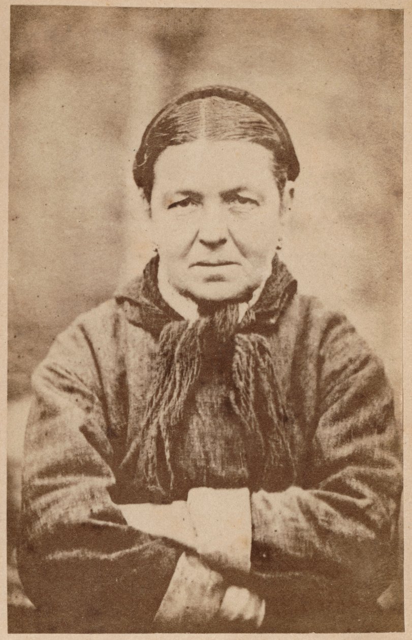 Epilepsia histérica, placa V de 
