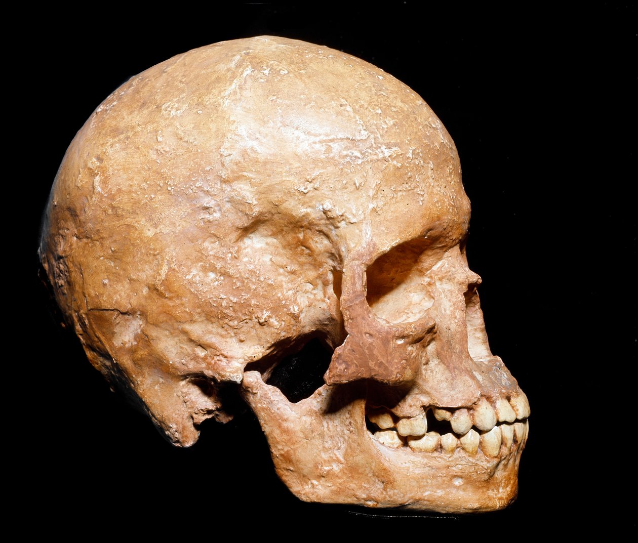 Prehistoria: cráneo fósil de Homo sapiens de Grimaldi. Cultura del Auriñaciense, Paleolítico superior. Museo Civico di Storia Naturale, Milán de Prehistoric Prehistoric