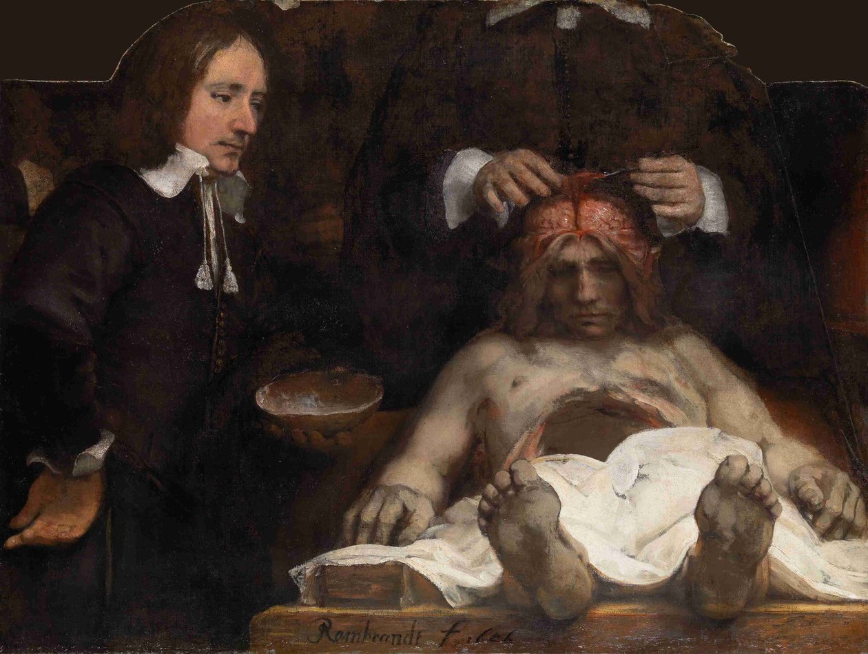 La lección de anatomía del Dr. Jan Deijman, 1656 de Rembrandt van Rijn