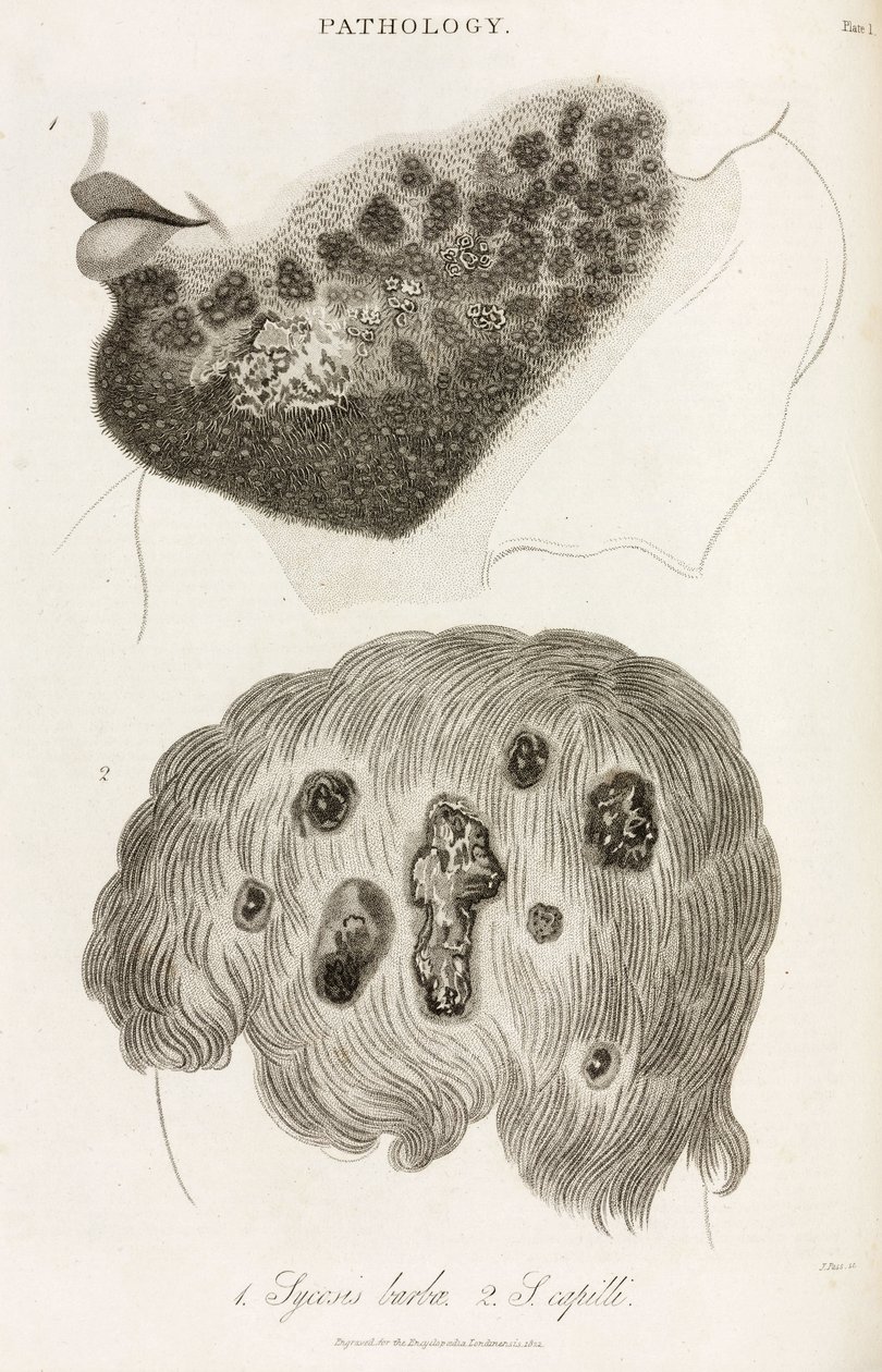 Dermatología Enfermedades de la piel de John Pardon