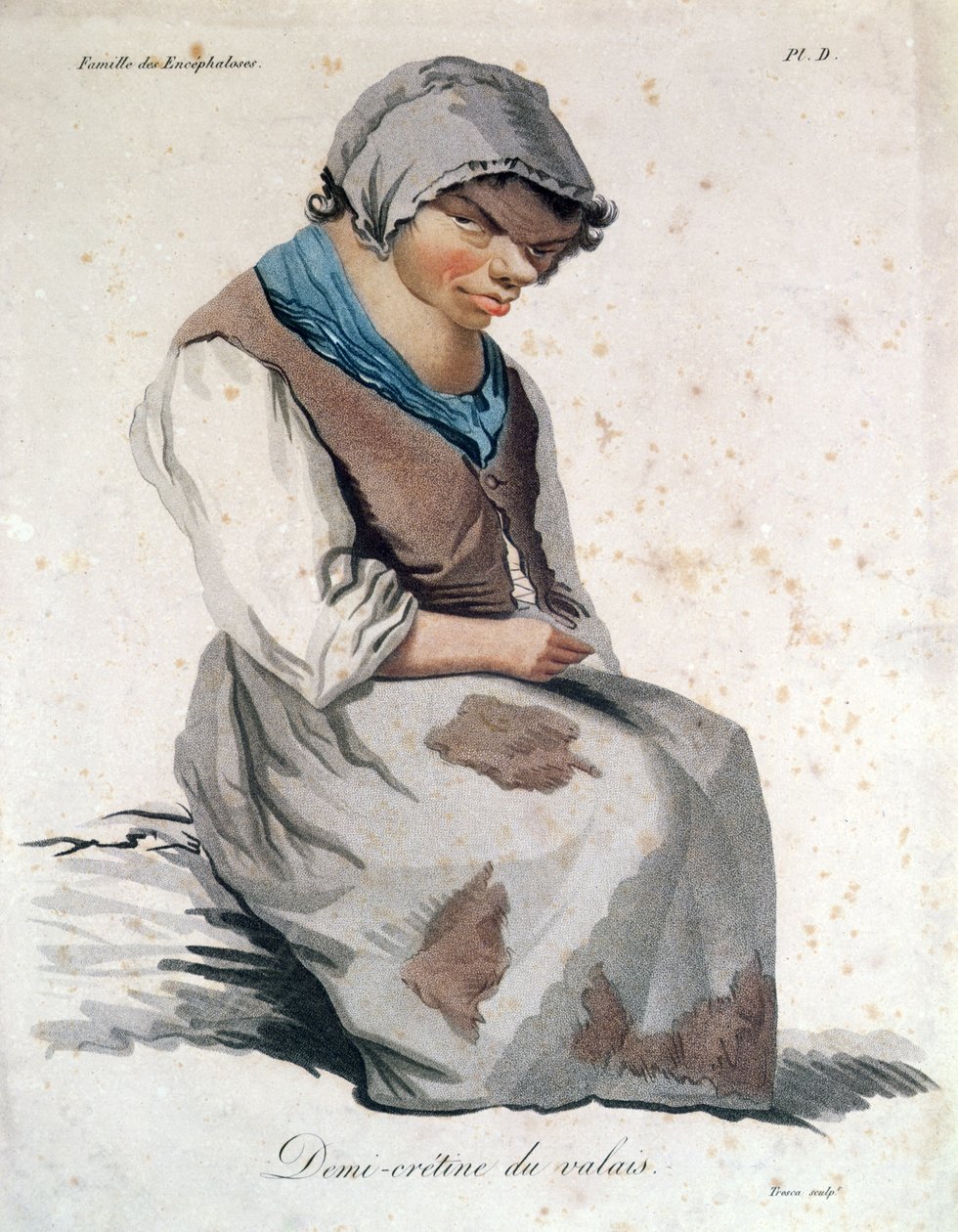 Cretino de Valais de Salvadore Tresca