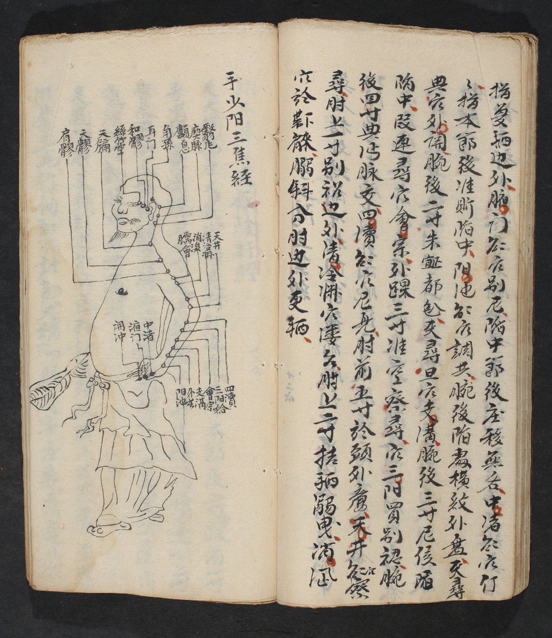 Puntos de acupuntura en el brazo, cuello y base de la cabeza, de Jing Guan Qi Zhi, 