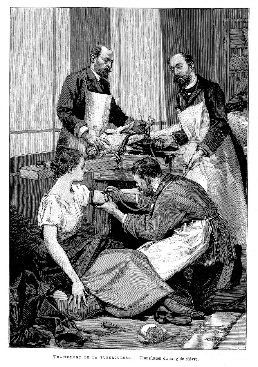 Paciente de tuberculosis recibiendo una transfusión de sangre de cabra, 1891 de Unbekannt