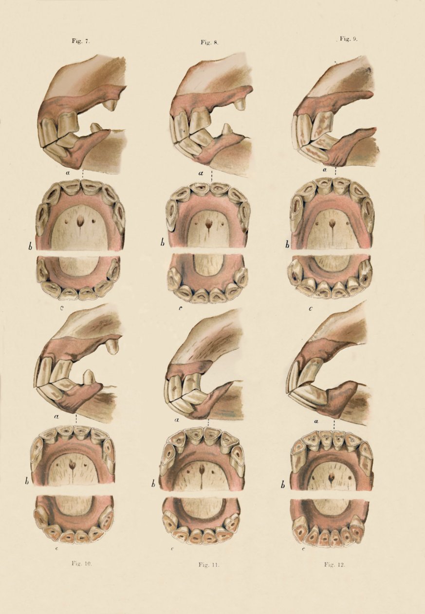 Descripción de la placa que muestra la edad, según lo indicado por los dientes, c1879 de Unbekannt