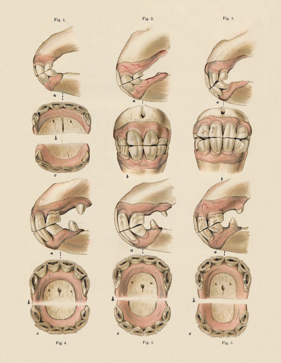 Descripción de la placa que muestra la edad, según lo indicado por los dientes, c1879 de Unbekannt