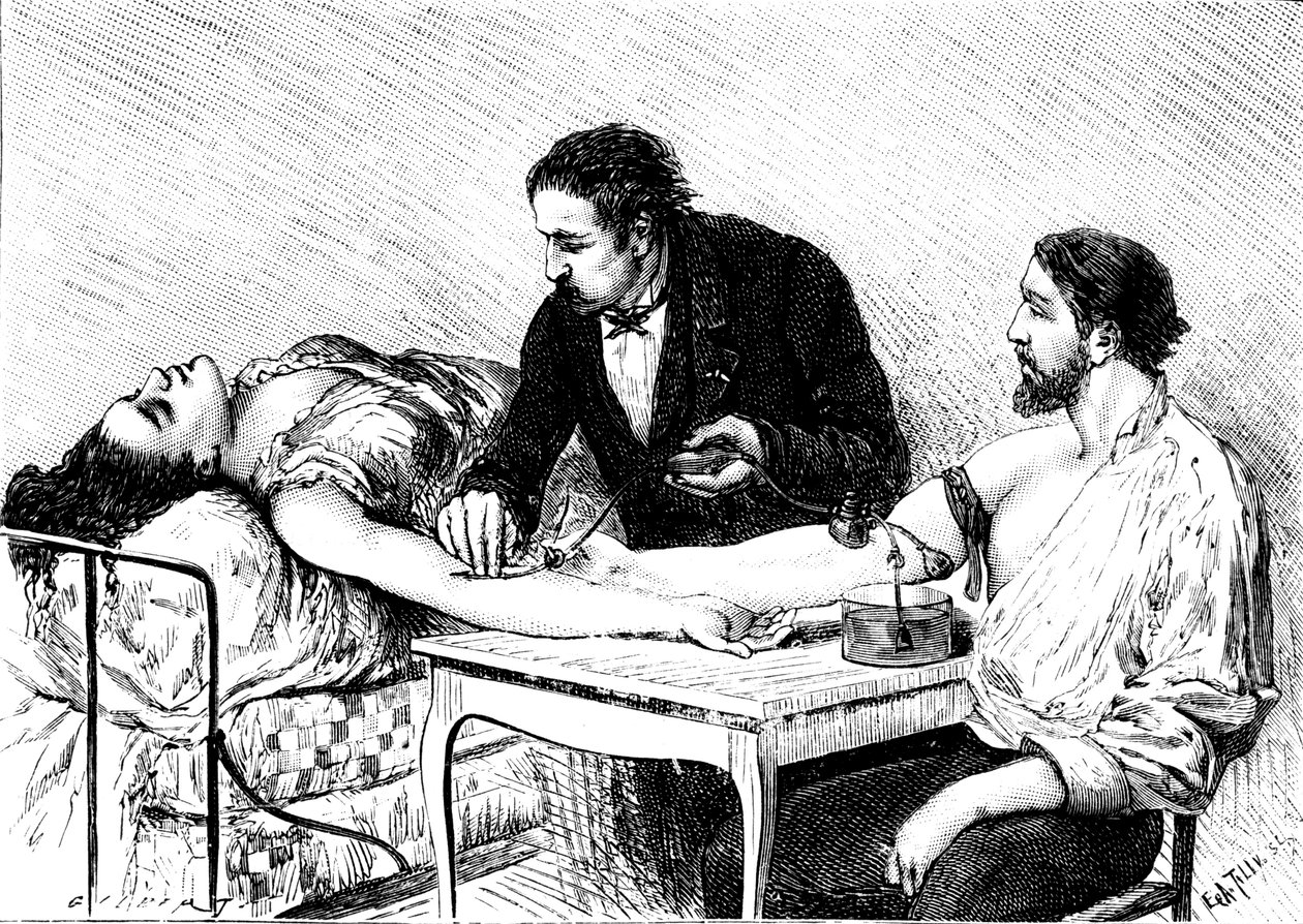 El Dr. Roussell de Ginebra realizando una transfusión de sangre directa a una mujer de un voluntario, 1882 de Unbekannt