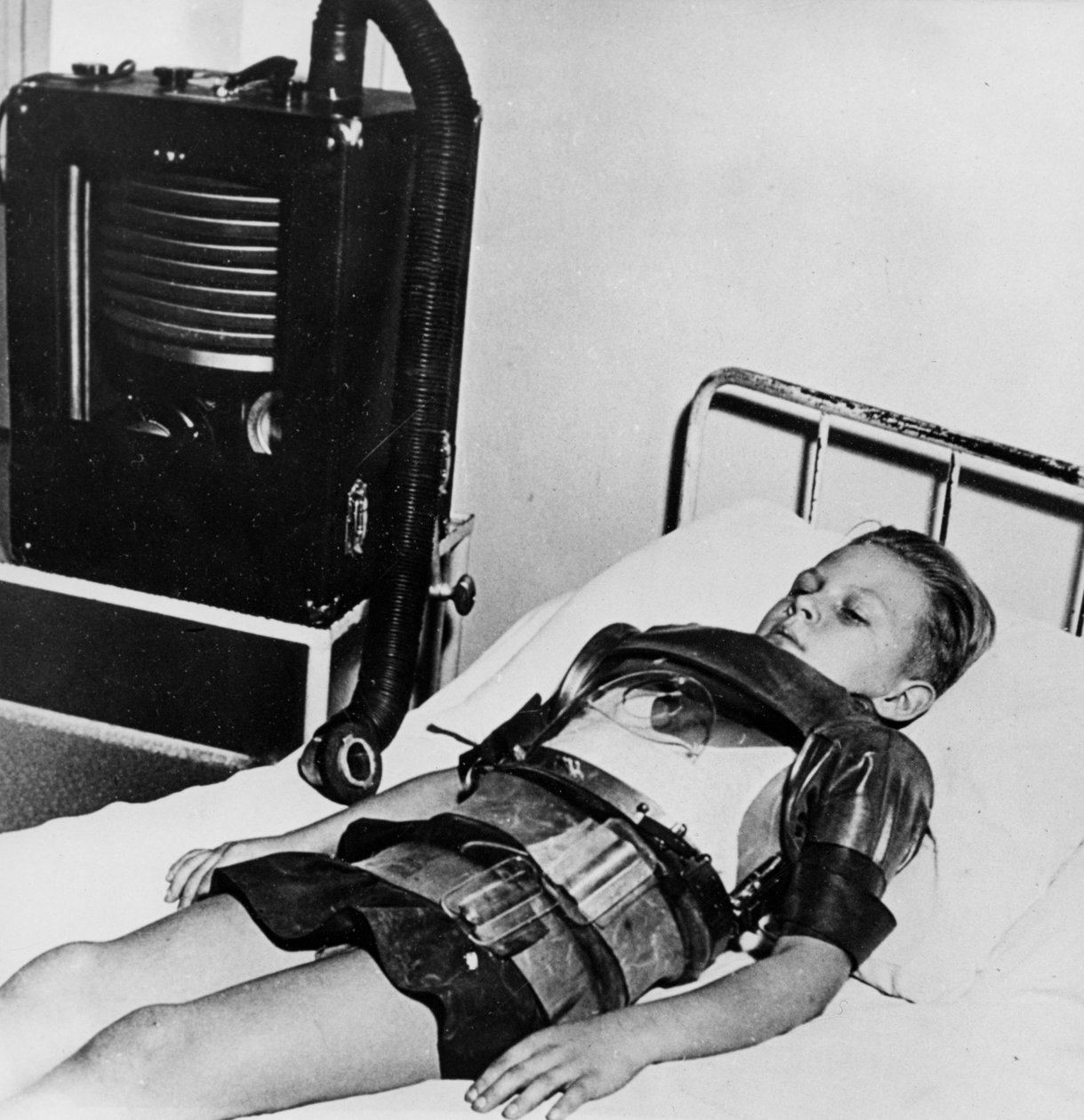 Niño de once años en un pulmón de acero, Hospital Beaujon, París, c1947-1951 de Unbekannt