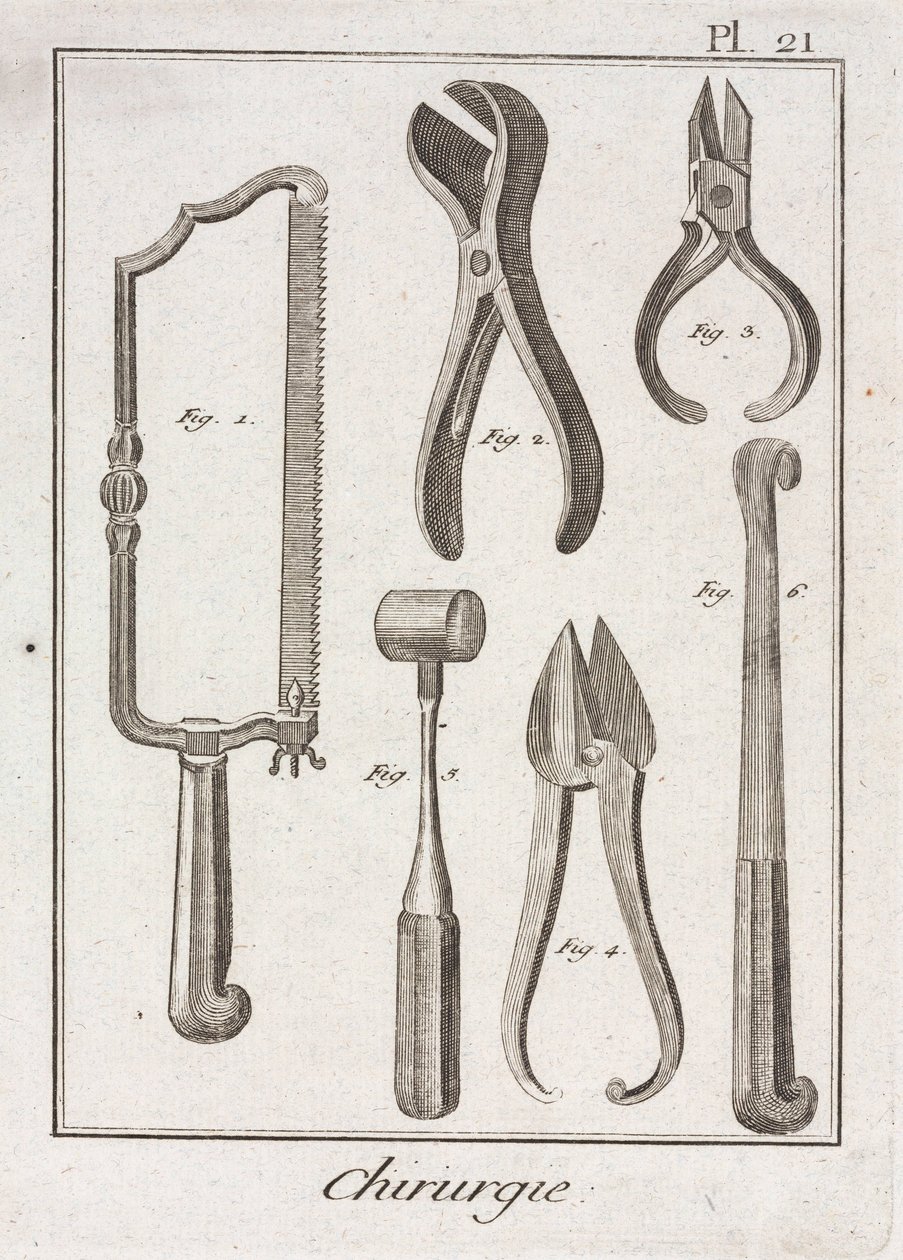 Equipamiento, sierra quirúrgica y otros instrumentos de la era moderna temprana de Unbekannt
