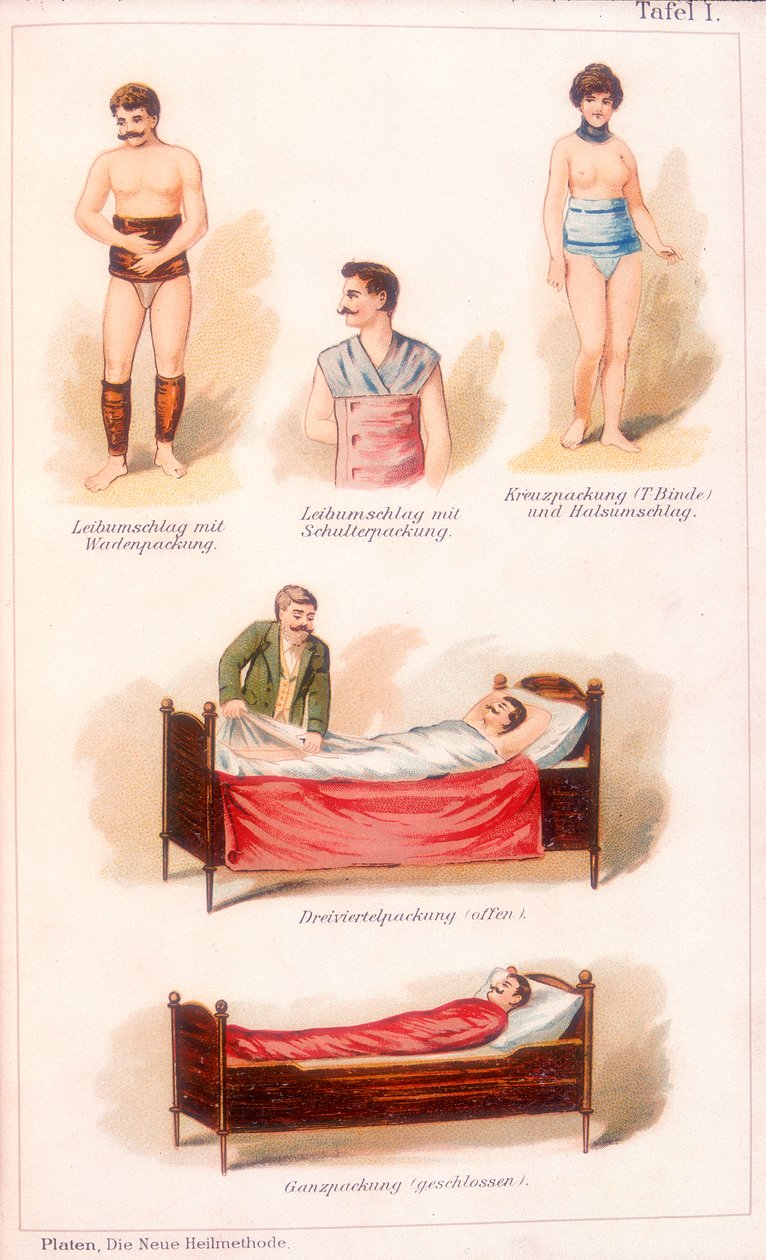 Tratamientos de hidroterapia de Unbekannt