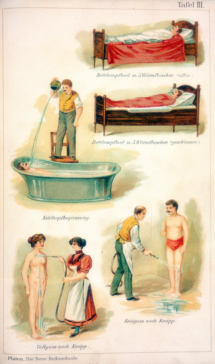 Tratamientos de Hidroterapia de Unbekannt