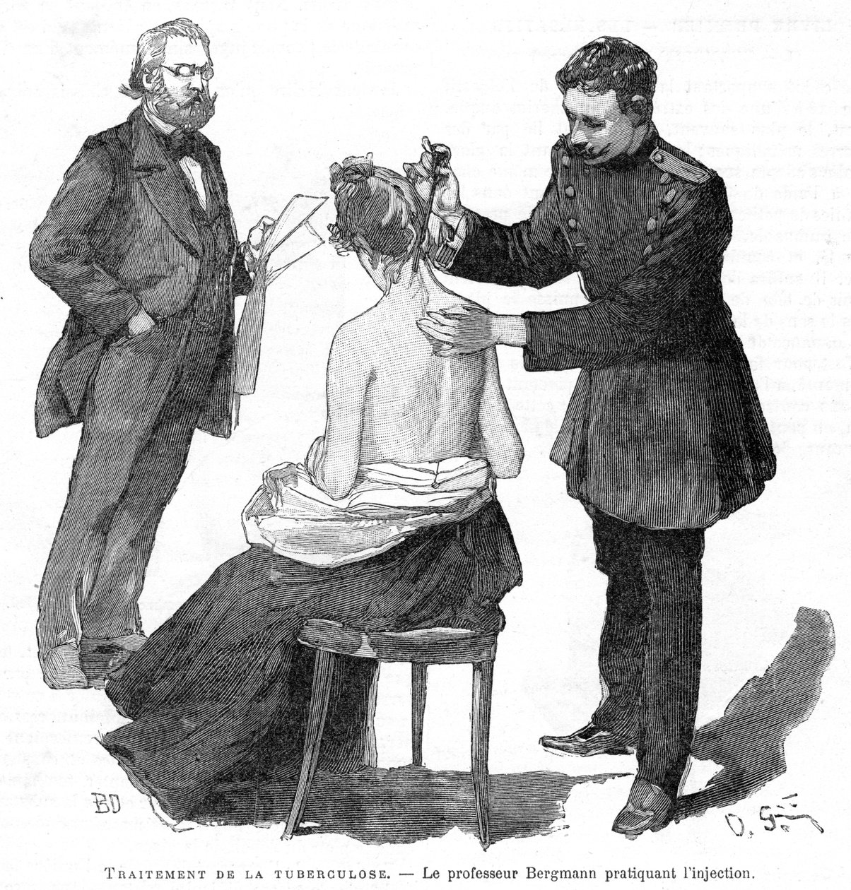 El profesor Bergmann inyectando a un paciente de tuberculosis, 1891 de Unbekannt