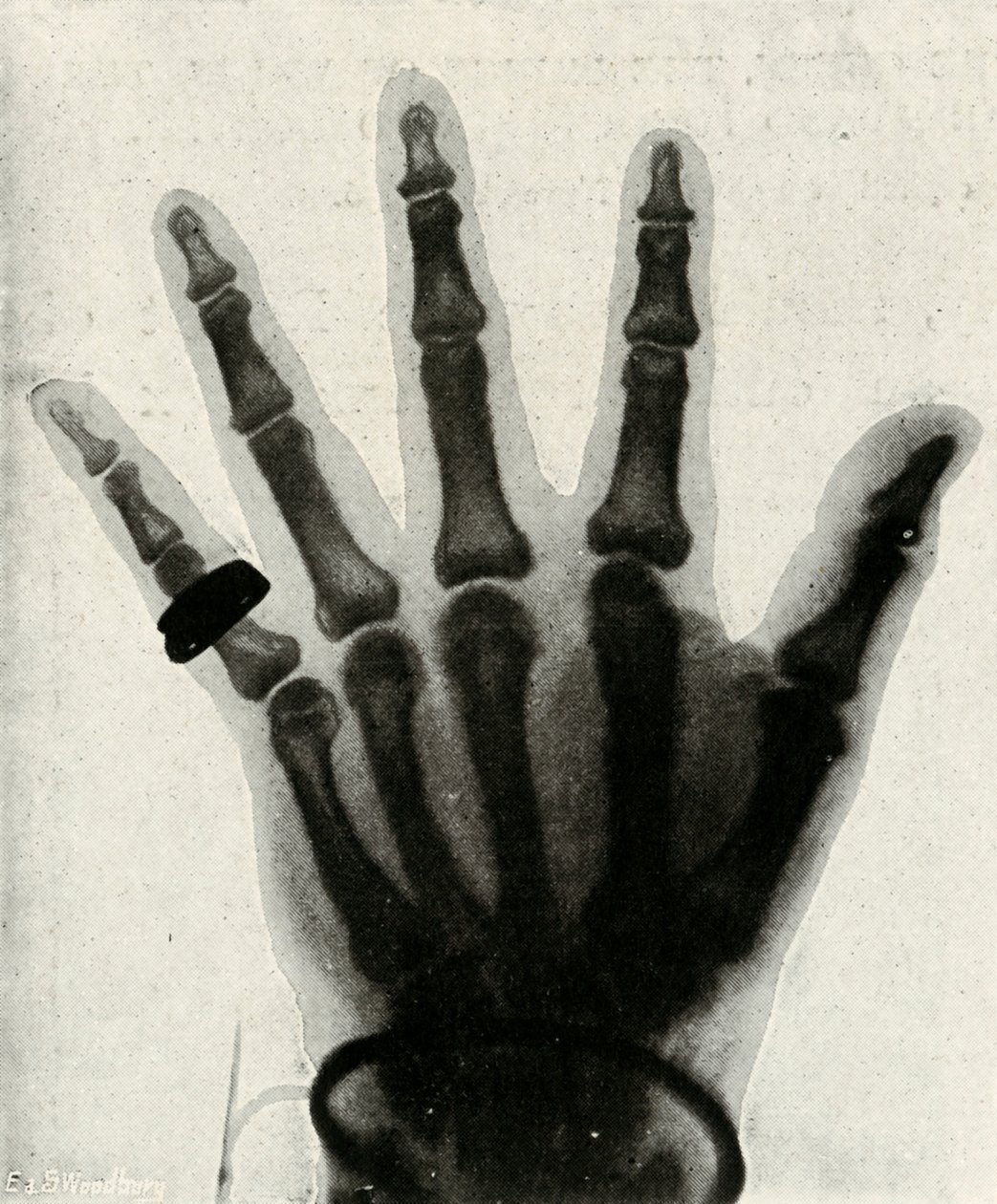 Radiografía de la mano de S.A.R. El Príncipe de Gales, c. 1897 de Unbekannt