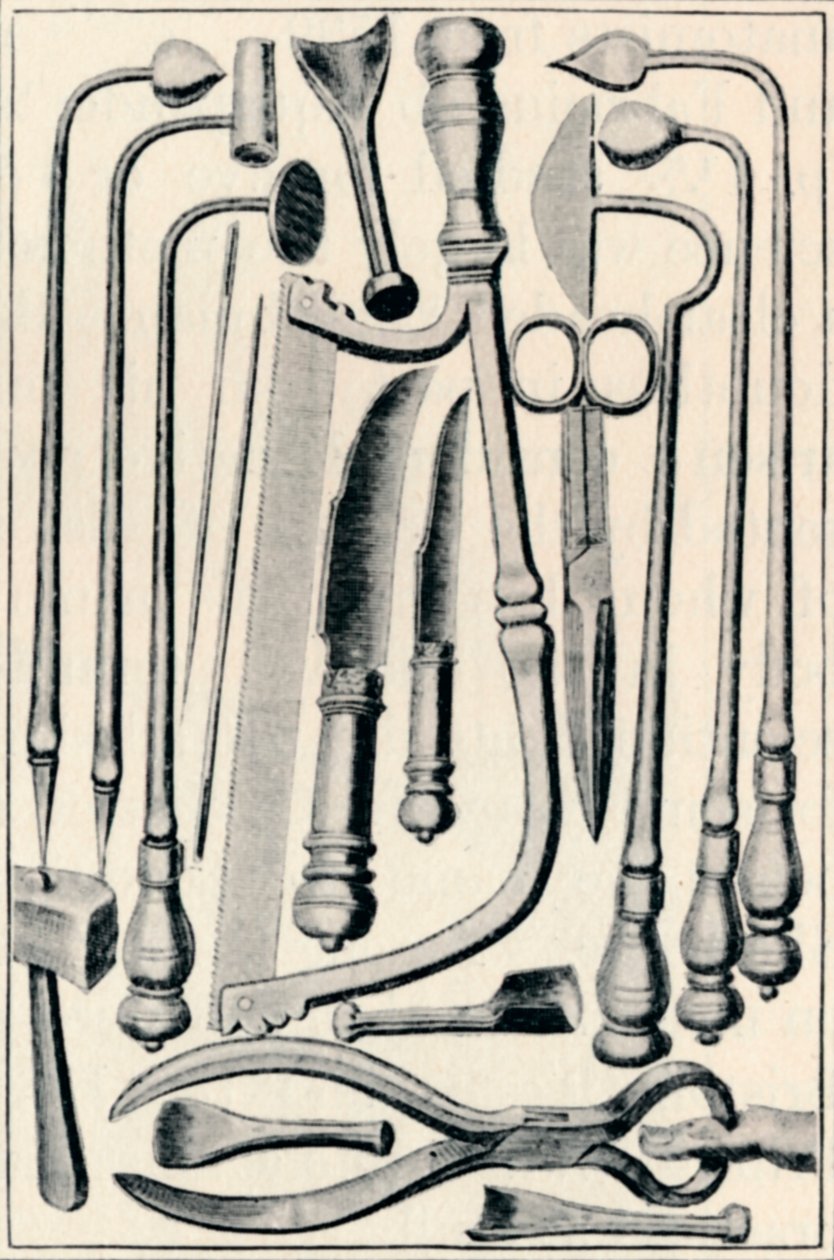 Instrumentos quirúrgicos, 1639 de Unbekannt