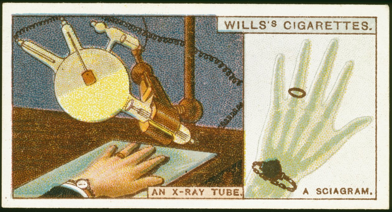 Radiografía de la mano, 1924 de Unbekannt