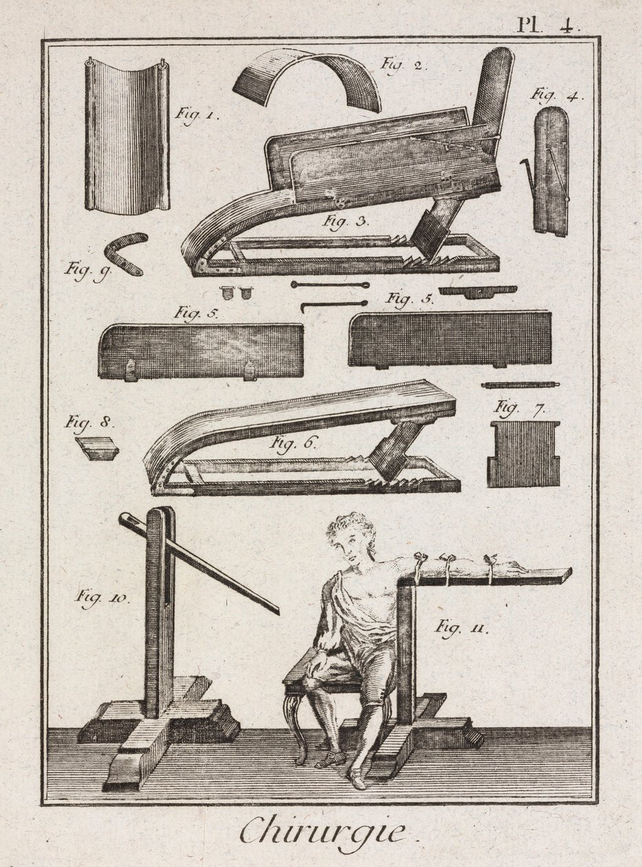 Equipamiento, Instrumentos de sangría de la Edad Moderna de Unbekannt
