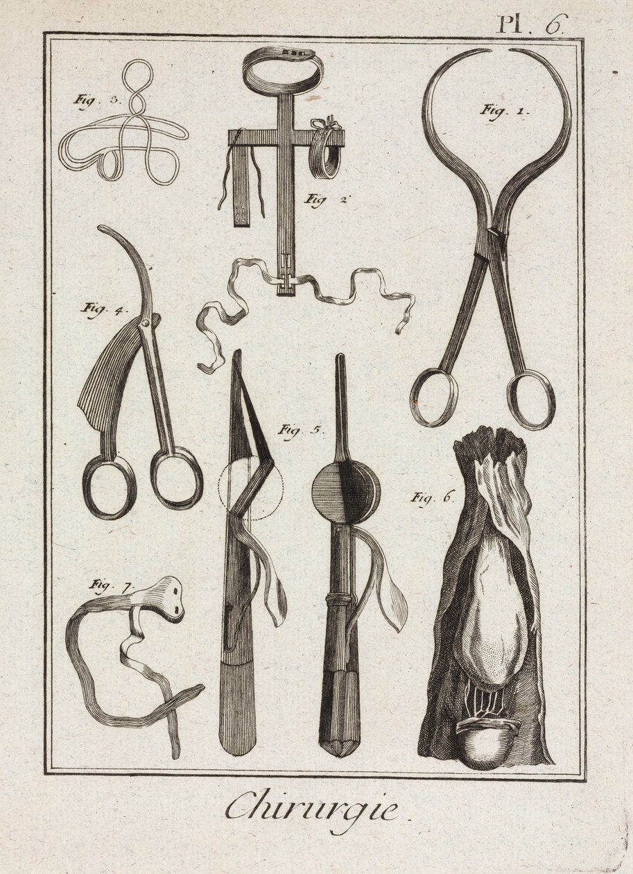 Equipamiento, Instrumentos quirúrgicos de la Edad Moderna de Unbekannt