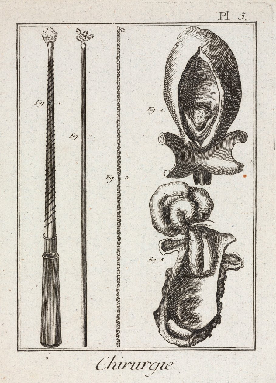 Equipamiento, Instrumentos quirúrgicos de la Edad Moderna y diagramas de partes del cuerpo de Unbekannt