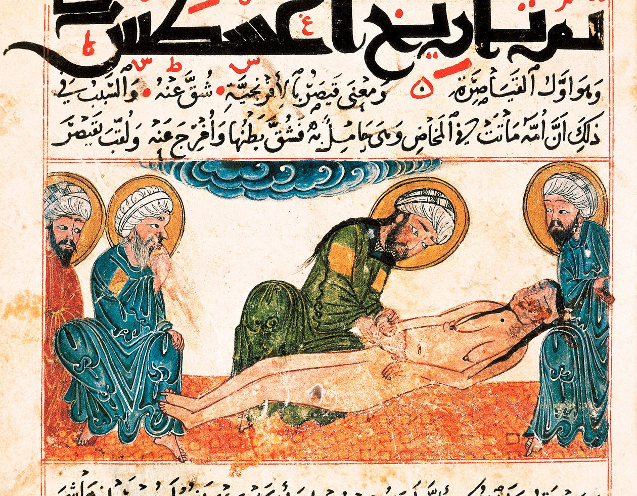 Representación de un parto por cesárea. Miniatura tomada de un manuscrito de medicina de Abu Raihan Al-Biruni (973-1048), intelectual y científico persa, folio 161. de Unbekannt